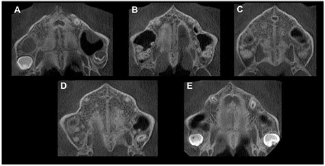 Afbeeldingsresultaten voor Maturation Effect