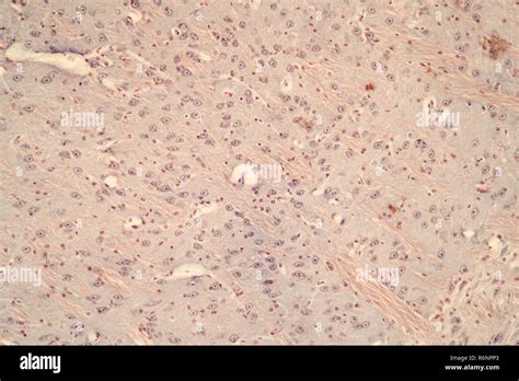 Toradh íomhá ar Mouse Under Microscope