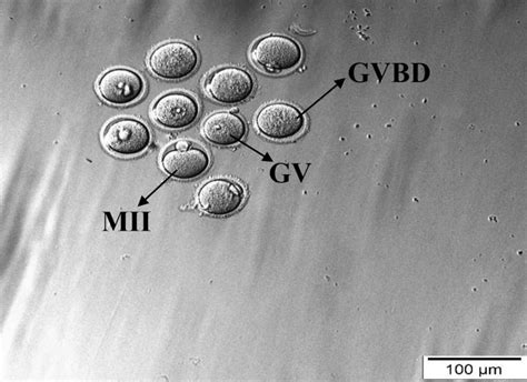 Image result for Oocyte Gvbd