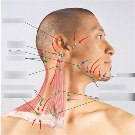Toradh íomhá ar Trapezius Lymph Node