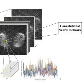 Toradh íomhá ar Convolutional Neural Network Spatial Dynamics