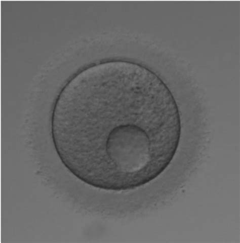 Oocyte Microscope Labeled に対する画像結果