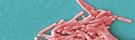 Image result for Legionella