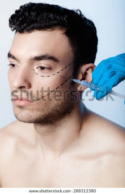 Image result for Crows Feet Jelly Roll Injection Pattern