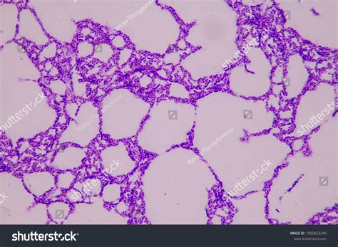 Bacteria Microscope Slides に対する画像結果