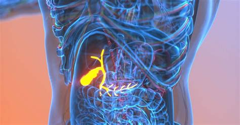 Image result for Gallbladder On CT Scan with Sludge