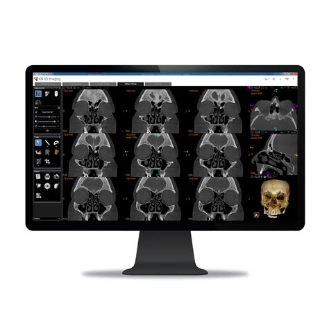 Image result for Carestream C9600