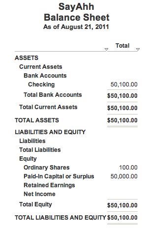 Image result for Share Capital Balance Sheet