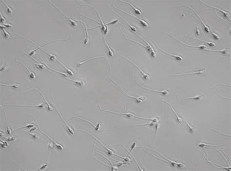 Image result for Sperm Cell and Light Microscope