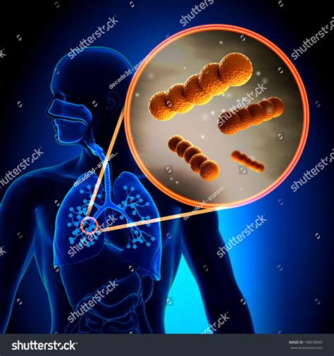 Image result for Strep Gram-positive