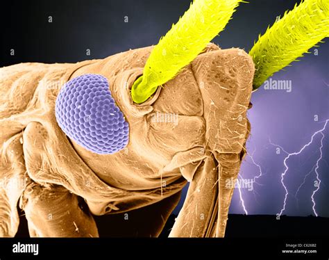 Image result for Electron Microscope Images Color