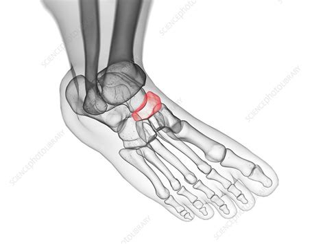 Image result for Navicular Bone Sprain