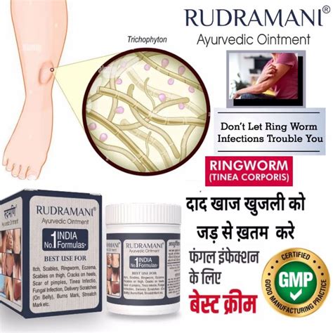 Afbeeldingsresultaten voor Ring Cutter Ointment