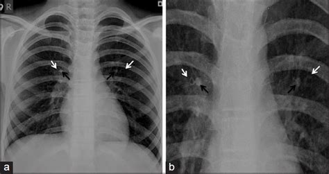 Image result for Spectacle Sign