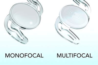 Image result for Refractive IOL Multifocal Optics