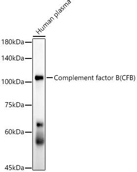 Complement Factor B Gene に対する画像結果