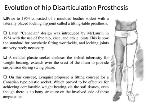 Image result for Disarticulation of Ossicles
