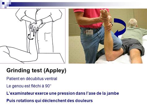 Toradh íomhá ar Dial Test Genou