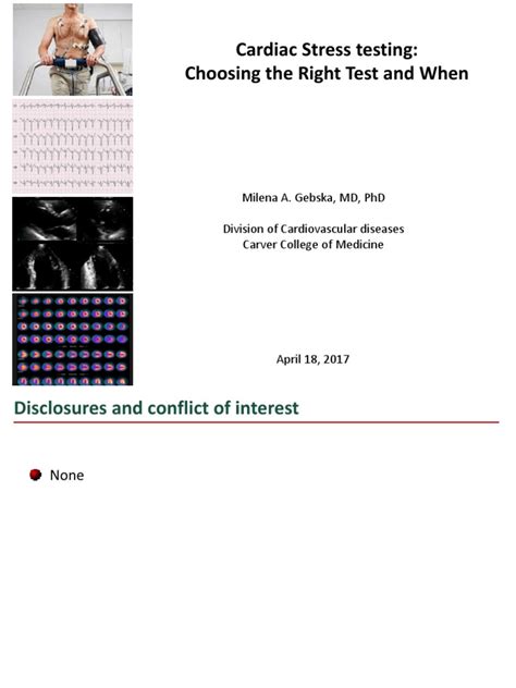 Image result for Cardiac Stress Test Algorithm