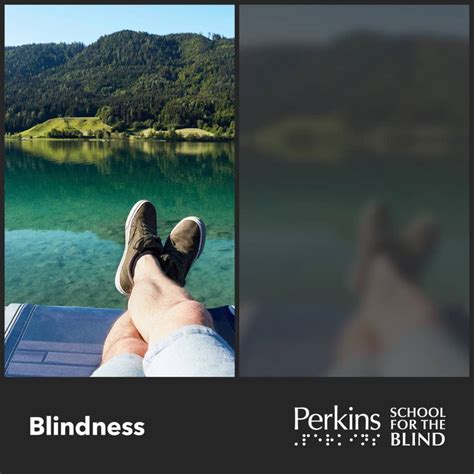 Image result for Visual Spatial Low Vision