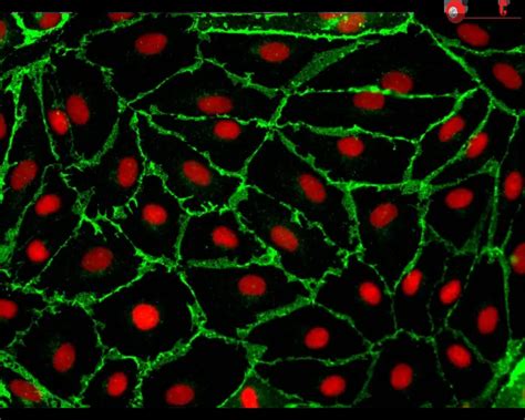 Image result for T17nrac in Human Microvascular Endothelial Cells
