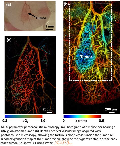 Afbeeldingsresultaten voor Optical Medical Imaging