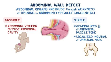 Image result for Abnormal Wall Defects Classification