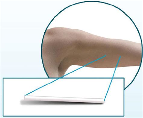 Image result for Nexplanon Cartoon