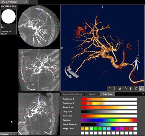 Canon 4D CT に対する画像結果