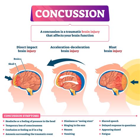 Image result for Impact Adult Test Concussion