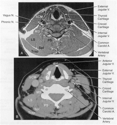 Image result for 4D Neck CT