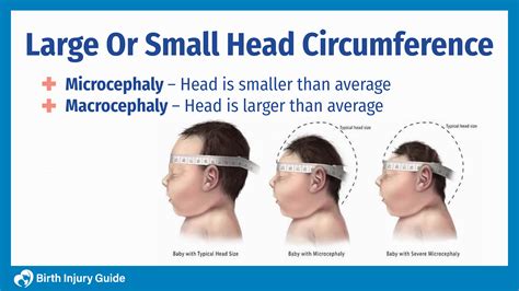 Toradh íomhá ar Abnormal Head Circumference