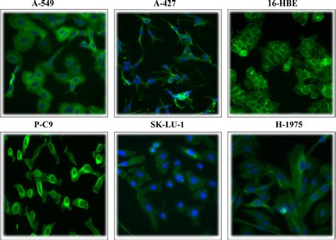 Afbeeldingsresultaten voor Microscopic View of Normal Cell Line