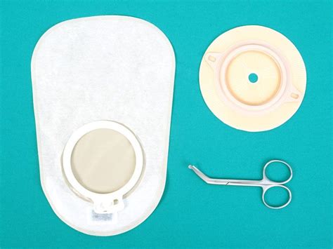 Image result for Types of Colostomy