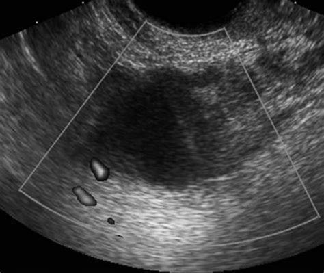 Yst White Paper に対する画像結果