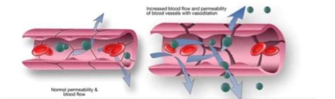 Distributive Shock Cartoon కోసం చిత్ర ఫలితం