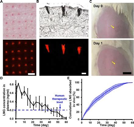 Image result for Separable Effervescent Microarray Patch