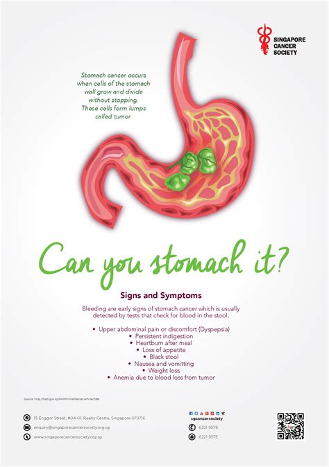 Image result for Neoadjuvant Chemotherapy Gastric Cancer