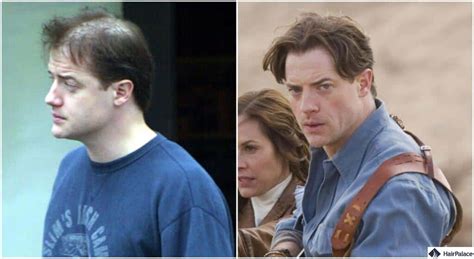 Brendan Fraser Before and After に対する画像結果