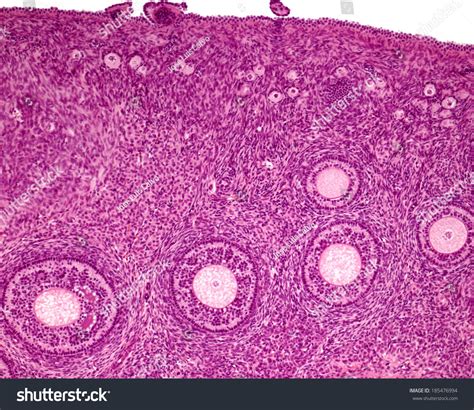 Image result for Oocyte Microscope Labeled