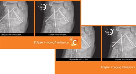 Image result for Carestream Visual Identity