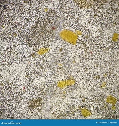 Toradh íomhá ar Max See Microscope