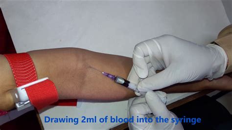 Afbeeldingsresultaten voor Blood Draw Collection