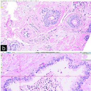 Image result for High Power Field Microscope