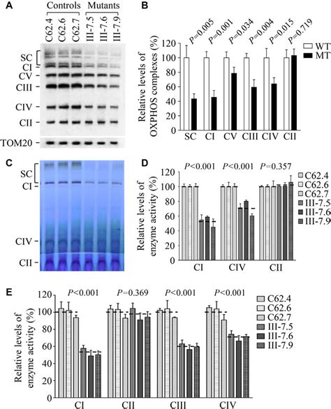 Image result for Ros and OXPHOS