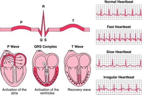 Afbeeldingsresultaten voor ECG Study