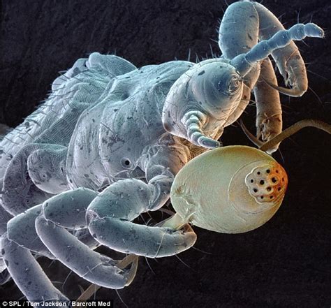 Image result for Insects Under Electron Microscope