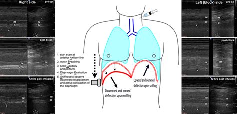 Image result for Normal Sniff Test
