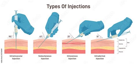 Research Method Injection に対する画像結果