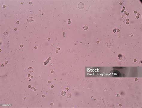 Toradh íomhá ar Triple Phosphate 5S rRNA